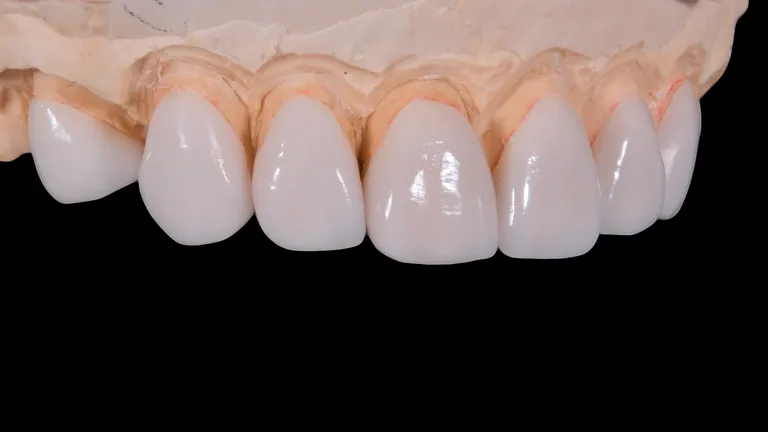 découvrez le métier d'assistant dentaire, un rôle essentiel au sein des cabinets dentaires. apprenez-en davantage sur les tâches, les compétences requises et les opportunités de carrière pour soutenir les dentistes et offrir des soins de qualité aux patients.